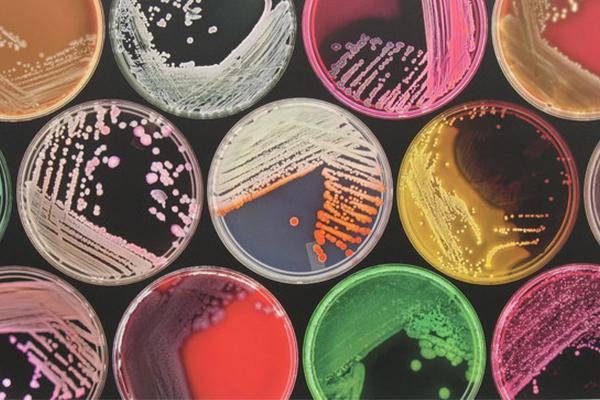 Image of petri dishes